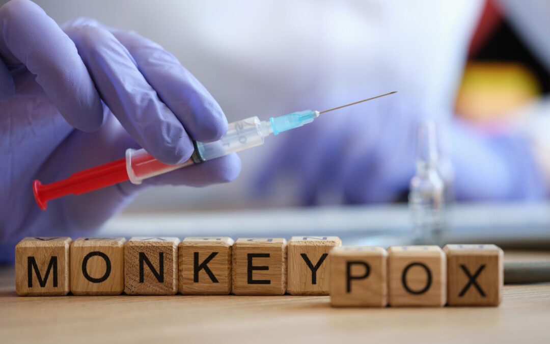 Monkeypox – What You Need To Know